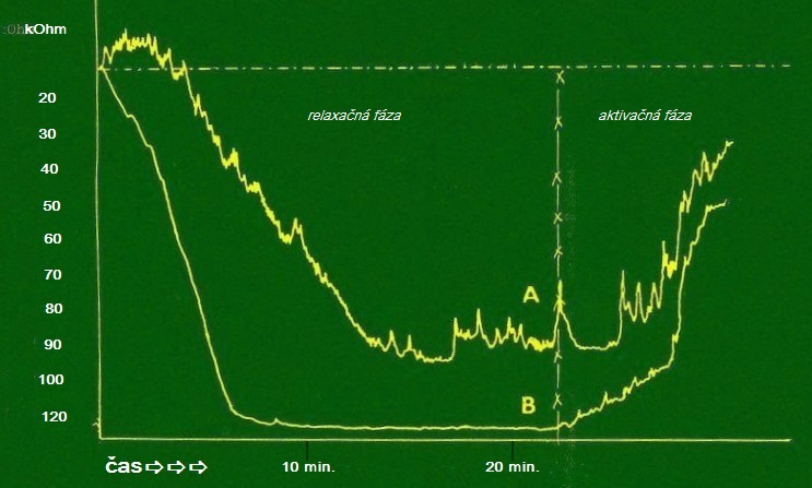 Galvanic skin response