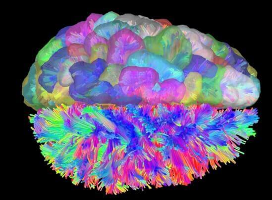 Scan mozgu ilustrujúci rozdielne reakcie hemisfér na smutnú hudbu